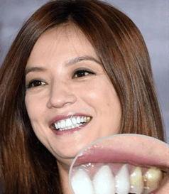 明星有带假牙,揭秘带假牙的明星风采