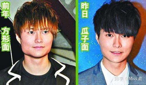 哪些明星有磨骨,揭秘磨骨手术的明星效应